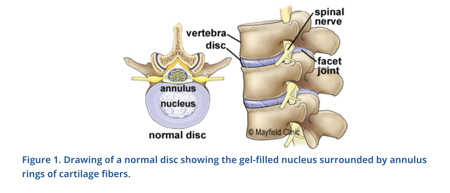 Artificial Cervical Disc Surgery - AANS image.